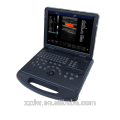 DW-C60 color Doppler embarazo escáner ultrasonido